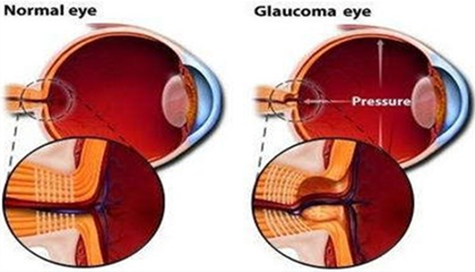 A Significant Progress Of Computer Aided Diagnosis System Using ...